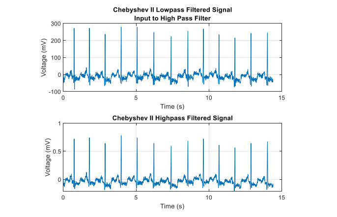 Signal Processing Projects