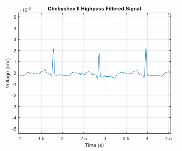 Final optimized ECG signal