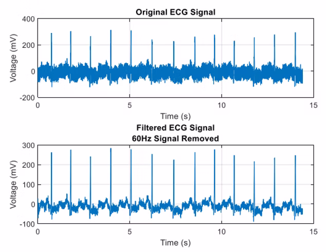 ECG after notch filtering